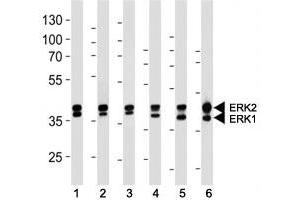 Western Blotting (WB) image for anti-Mitogen-Activated Protein Kinase 1/3 (MAPK1/3) antibody (ABIN3031826)