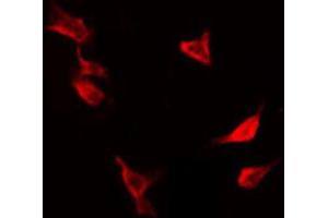 ABIN6267416 staining Hela by IF/ICC. (PTPN1 antibody  (pSer50))
