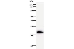 Western Blotting (WB) image for anti-Transportin 3 (TNPO3) antibody (ABIN933162) (Transportin 3 antibody)