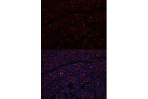 Immunofluorescence (IF) image for anti-Cadherin 2 (CDH2) (AA 750-850) antibody (ABIN3017243)