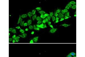 Immunofluorescence analysis of MCF-7 cells using RASSF1 Polyclonal Antibody