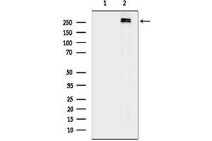 anti-Acetyl-CoA Carboxylase alpha (ACACA) (pSer79) antibody