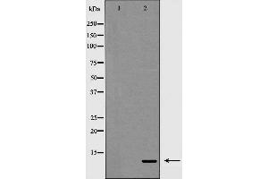 Western blot analysis on 293 cell lysate using Insulin Antibody,The lane on the left is treated with the antigen-specific peptide.