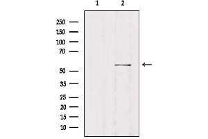 Western blot analysis of extracts from B16F10, using WASF2 Antibody. (WASF2 antibody  (Internal Region))