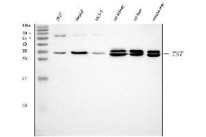 Western blot analysis of TST using anti-TST antibody (ABIN7599105).