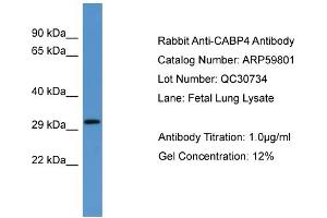 WB Suggested Anti-CABP4  Antibody Titration: 0.