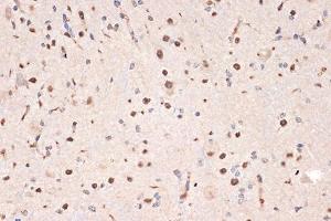 Immunohistochemistry of paraffin-embedded mouse spinal cord using DDX17 Rabbit mAb (ABIN7266688) at dilution of 1:100 (40x lens). (DDX17 antibody)