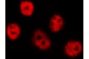 ABIN6267553 staining NIH-3T3 by IF/ICC. (LIMK-1/2 (pThr505), (pThr508) antibody)