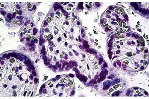 Human Placenta: Formalin-Fixed, Paraffin-Embedded (FFPE) (KLF11 antibody  (AA 404-513))