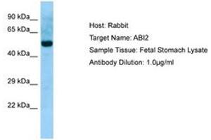 Image no. 1 for anti-Abl-Interactor 2 (ABI2) (N-Term) antibody (ABIN6749949) (ABI2 antibody  (N-Term))