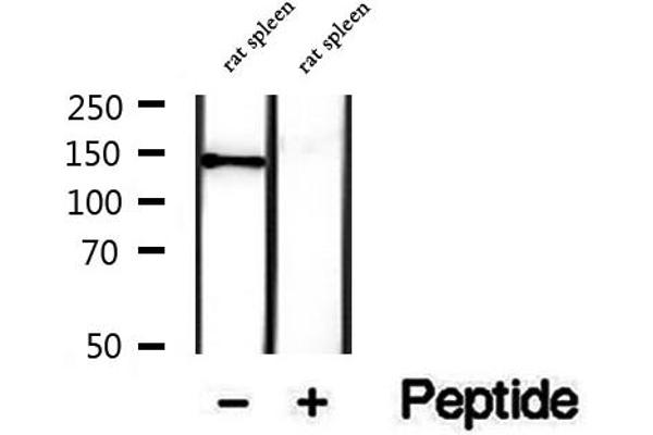 DHX9 抗体  (C-Term)
