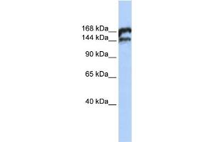 WB Suggested Anti-TOP2B Antibody Titration:  0. (TOP2B antibody  (Middle Region))