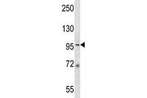 MCM6 antibody western blot analysis in 293 lysate. (MCM6 antibody  (AA 80-109))