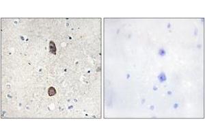 Immunohistochemistry analysis of paraffin-embedded human brain, using IGFBP-3 (Phospho-Ser183) Antibody. (IGFBP3 antibody  (pSer183))