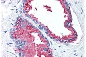 Immunohistochemistry (Formalin/PFA-fixed paraffin-embedded sections) of human prostate with LOXL2 polyclonal antibody . (LOXL2 antibody  (Internal Region))