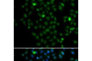 LMO4 antibody