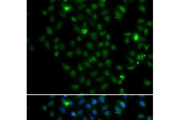 LMO4 antibody