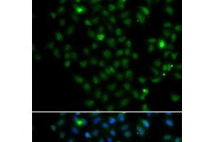Immunofluorescence analysis of MCF-7 cells using LMO4 Polyclonal Antibody