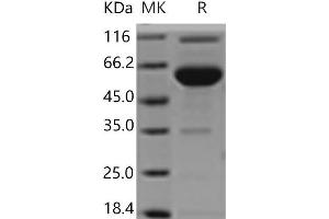 Western Blotting (WB) image for Endothelial Cell Adhesion Molecule (ESAM) protein (Fc Tag) (ABIN7321176) (ESAM Protein (Fc Tag))