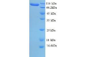 SDS-PAGE (SDS) image for Eukaryotic Translation Elongation Factor 2 (EEF2) (AA 2-858) protein (His tag) (ABIN5709437) (EEF2 Protein (AA 2-858) (His tag))
