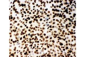 ICC testing of (m) NIH3T3 cells (MCM2 antibody  (AA 884-904))