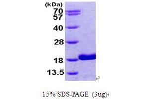 SDS-PAGE (SDS) image for Retinol Binding Protein 5, Cellular (RBP5) (AA 1-135) protein (His tag) (ABIN667828)