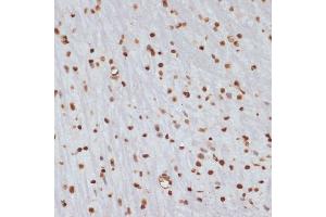 Immunohistochemistry of paraffin-embedded mouse brain using Phospho-Chk1-S280 antibody (ABIN3019445, ABIN3019446, ABIN3019447 and ABIN6225372) at dilution of 1:100 (40x lens). (CHEK1 antibody  (pSer280))