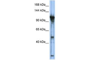WB Suggested Anti-GTF3C2 Antibody Titration:  0. (GTF3C2 antibody  (Middle Region))