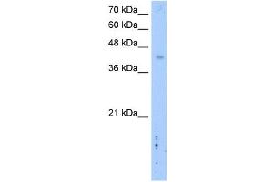 WB Suggested Anti-LRRC2 Antibody Titration: 2. (LRRC2 antibody  (C-Term))