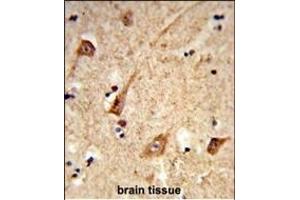 Formalin-fixed and paraffin-embedded human brain tissue reacted with GALNT2 Antibody (N-term), which was peroxidase-conjugated to the secondary antibody, followed by DAB staining. (GALNT2 antibody  (N-Term))