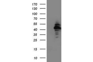 HEK293T cells were transfected with the pCMV6-ENTRY control (Left lane) or pCMV6-ENTRY NAPEPLD (Right lane) cDNA for 48 hrs and lysed. (NAPEPLD antibody)