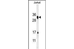 Western blot analysis in Jurkat cell line lysates (15ug/lane). (R-Spondin 4 antibody  (C-Term))