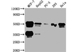 Western Blotting (WB) image for anti-Forkhead Box A1 (FOXA1) antibody (ABIN7127498)