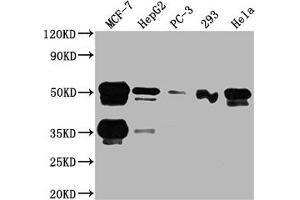 Western Blot Positive WB detected in: MCF-7 whole cell lysate, HepG2 whole cell lysate, PC-3 whole cell lysate, 293 whole cell lysate, Hela whole cell lysate All lanes: FOXA1 antibody at 1:2000 Secondary Goat polyclonal to rabbit IgG at 1/50000 dilution Predicted band size: 50, 46 kDa Observed band size: 50 kDa (Recombinant FOXA1 antibody)
