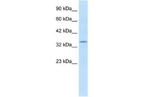 KCNAB2 antibody used at 1. (KCNAB2 antibody  (C-Term))