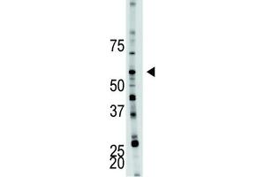 Western Blotting (WB) image for anti-6-phosphofructo-2-Kinase/fructose-2,6-Biphosphatase 4 (PFKFB4) antibody (ABIN3003725) (PFKFB4 antibody)