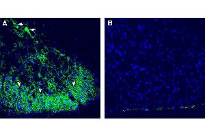 Expression of CALHM2 in rat spinal cord. (CALHM2 antibody  (Extracellular))
