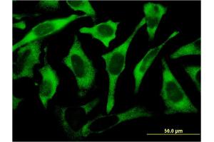 Immunofluorescence of monoclonal antibody to RPL17 on HeLa cell. (RPL17 antibody  (AA 1-184))