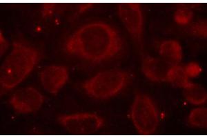 Immunofluorescence (IF) image for anti-Nuclear Factor-kB p65 (NFkBP65) (pSer468) antibody (ABIN3020478) (NF-kB p65 antibody  (pSer468))