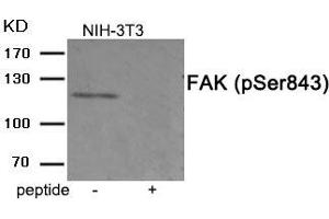 Western blot analysis of extracts from 3T3 cells treated with PMA using Phospho-FAK (Ser843) antibody. (FAK antibody  (pSer843))