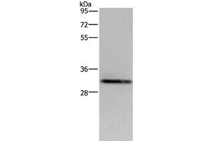 Western Blot analysis of OP9 cell using CD242 Polyclonal Antibody at dilution of 1:500 (ICAM4 antibody)