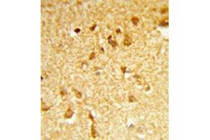 Formalin-fixed and paraffin-embedded human brain tissue reacted with DDX17 Antibody (N-term) followed which was peroxidase-conjugated to the secondary antibody, followed by DAB staining. (DDX17 antibody  (N-Term))