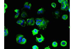 Immunofluorescent analysis of MCF-7 cells using ABIN7171548 at dilution of 1:100 and Alexa Fluor 488-congugated AffiniPure Goat Anti-Rabbit IgG(H+L) (TAS2R41 antibody  (AA 205-234))