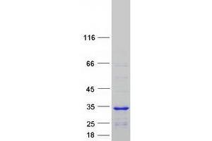 Validation with Western Blot (CCDC103 Protein (Myc-DYKDDDDK Tag))