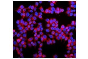 IF analysis of Stathmin 1 using anti-Stathmin 1 antibody (ABIN3043301). (Stathmin 1 antibody  (N-Term))