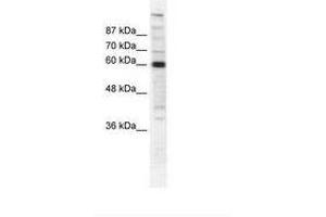 Image no. 1 for anti-Polymerase (RNA) II (DNA Directed) Polypeptide B, 140kDa (POLR2B) (AA 119-168) antibody (ABIN202976)