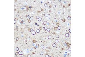 Immunohistochemistry of paraffin-embedded Rat brain using EY Rabbit pAb (ABIN6135167, ABIN6140386, ABIN6225031 and ABIN6225033) at dilution of 1:100 (40x lens). (EYA1 antibody  (AA 100-250))