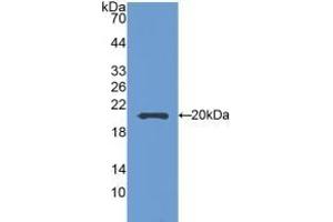 Detection of Recombinant SEMA5B, Mouse using Polyclonal Antibody to Semaphorin 5B (SEMA5B) (SEMA5B antibody  (AA 836-1013))