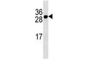 Western Blotting (WB) image for anti-Tumor Necrosis Factor Receptor Superfamily, Member 17 (TNFRSF17) (AA 63-92) antibody (ABIN3029362)