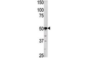 Western Blotting (WB) image for anti-Phosphoglycerate Kinase 2 (PGK2) antibody (ABIN3003022)
